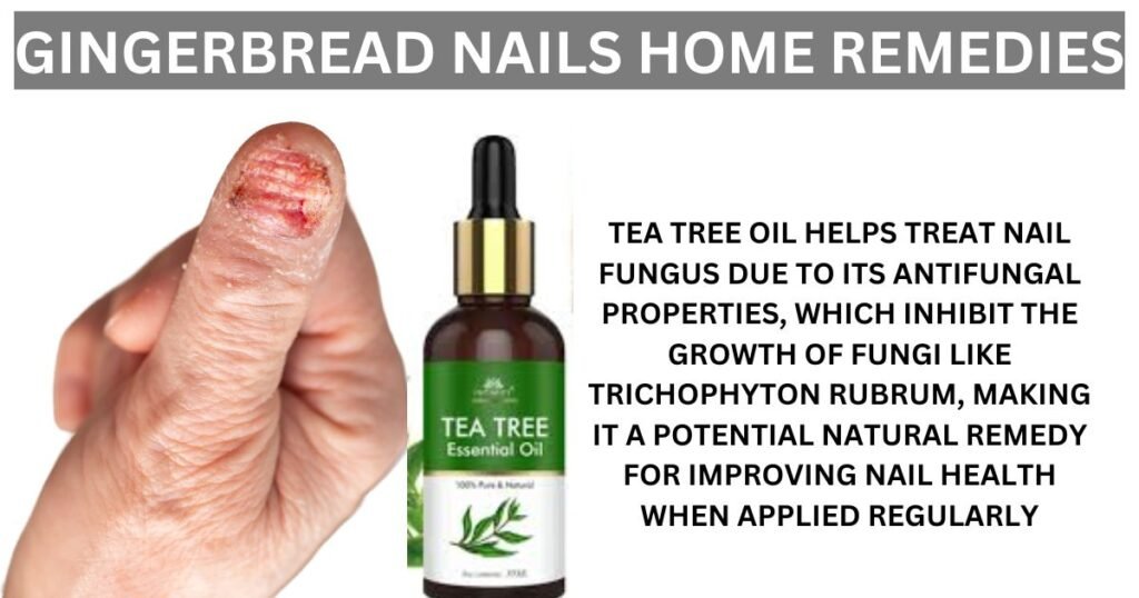 Gingerbread Nails home remedies