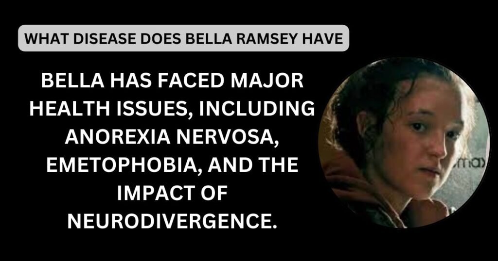 What Disease Does Bella Ramsey Have