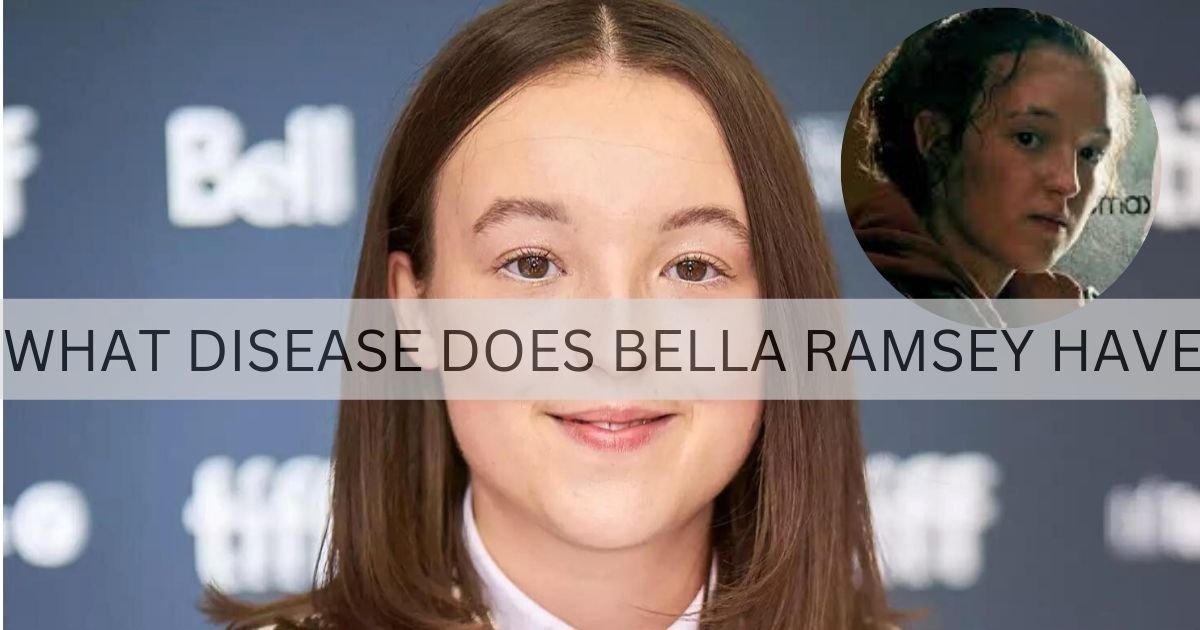 what disease does bella ramsey have