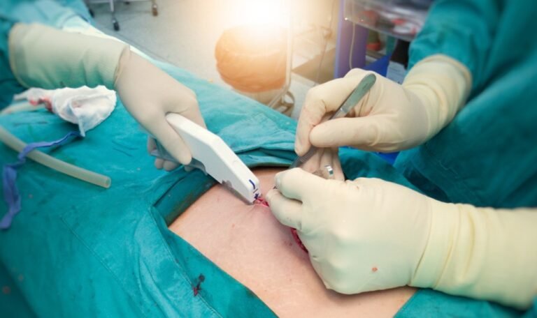 The Role of Surgical Stapler Reloads in Modern Operating Rooms